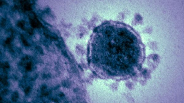 1100 Middle East Respiratory Syndrome Related Coronavirus