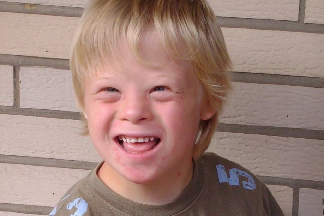 Boy With Downs Syndrome